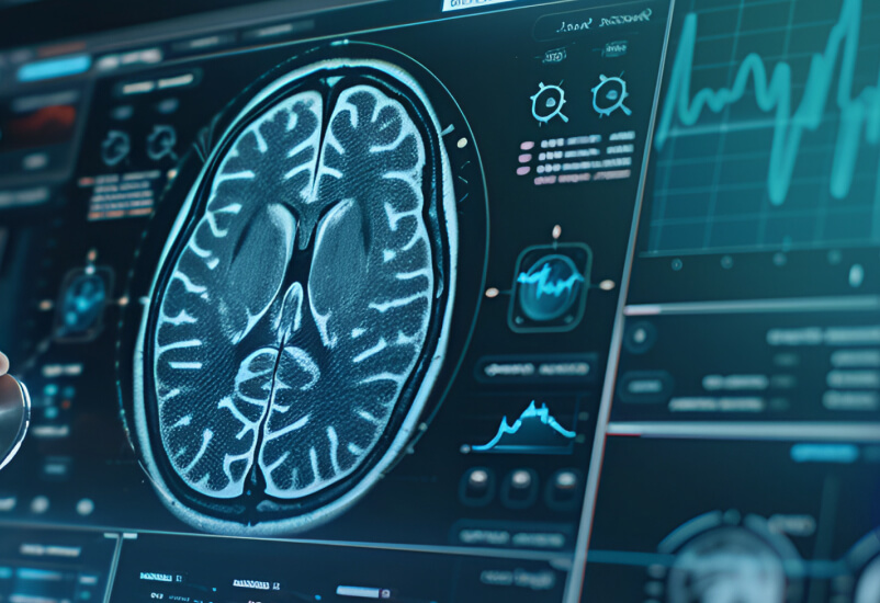 Futuristic interface showing a brain scan